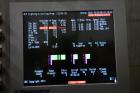 Used Battenfeld Gloucester 36” Wide Inclined Sheet Line.