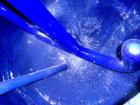 Used Pfaudler Glass Lined Reactor, 300 Gallon, 5015 Blue Glass, Vertical. Internal rated 25 psi and full vacuum at 450 deg F, carbon steel jacket rated 95 psi and full vacuum at 350 deg F. 4DTW Pfaud...